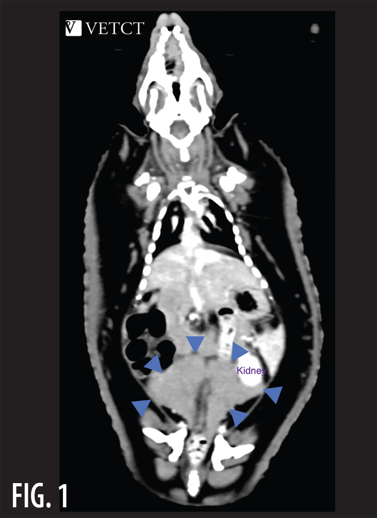 Screenshot of a medical CT scan displaying a suspected normal hedgehog anatomy structure area